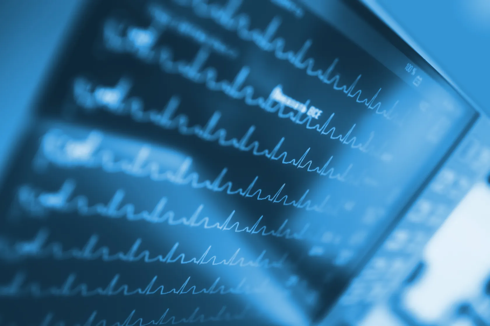 Close-up of a digital data or medical screen